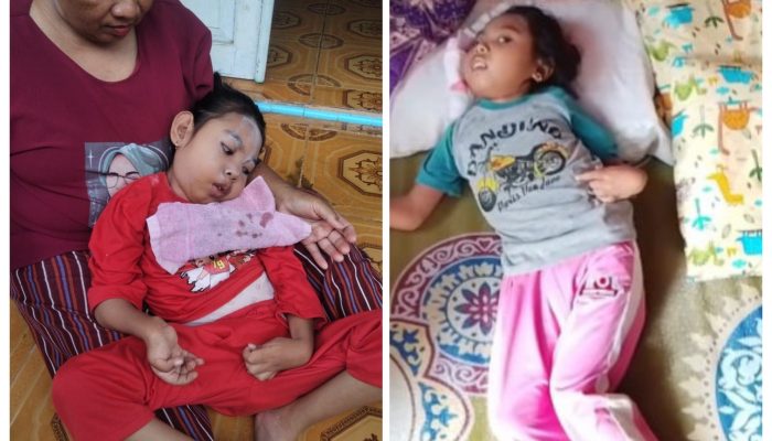 Ketua BARA Merespon dan akan Berupaya Carikan Kursi Roda Untuk Citra (10) Penyandang Disabilitas di Desa Ciasem Hilir