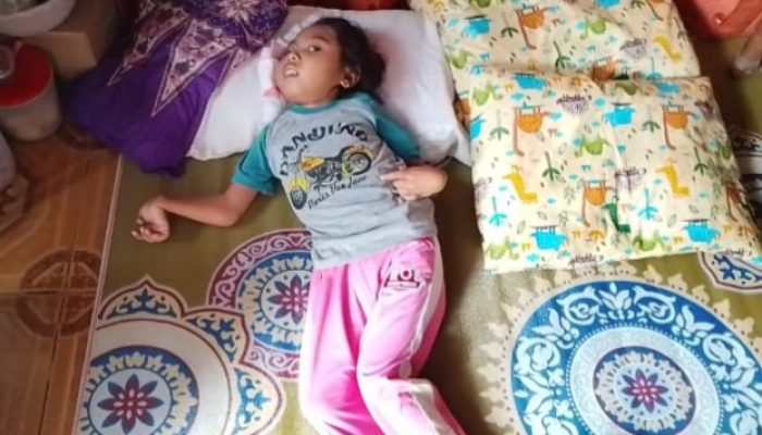 Citra Amelinda (10) Anak Disabilitas Butuh Kursi Roda