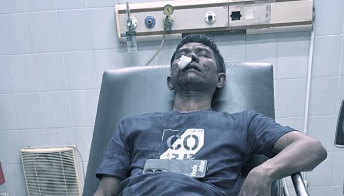 Seorang Wartawan di Subang Jadi Korban Aksi Premanisme Sejumlah Orang