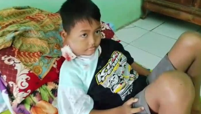 Harapan Kecil Dede Saputra: 7 Bulan Menahan Derita Tumor Ganas Stadium 4
